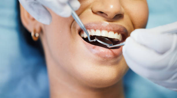 Best Emergency Broken Tooth Repair in Thatcher, UT